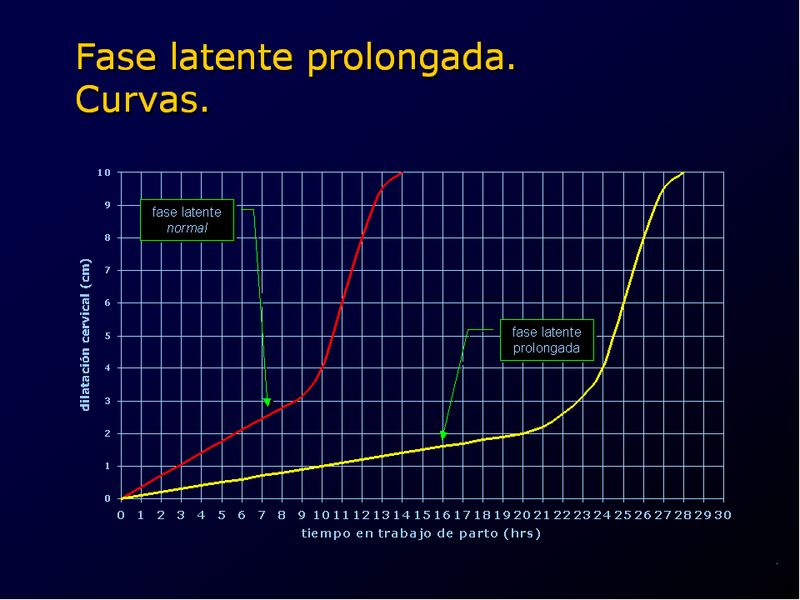 Diapositiva/Slide: 29/94