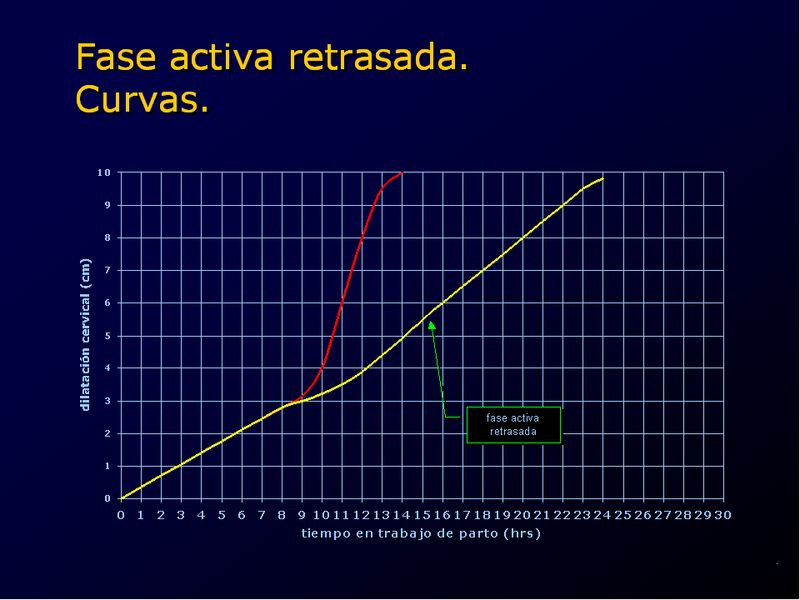 Diapositiva/Slide: 34/94