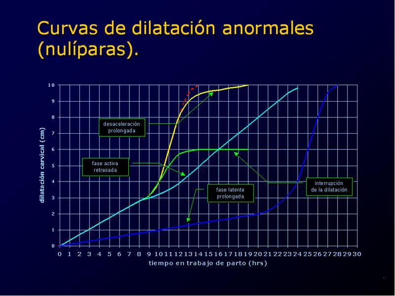 Diapositiva/Slide: 55/94