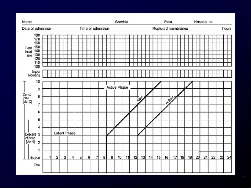 Diapositiva/Slide: 62/94