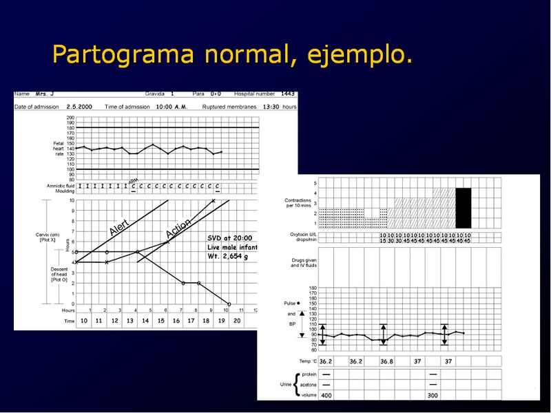 Diapositiva/Slide: 70/94