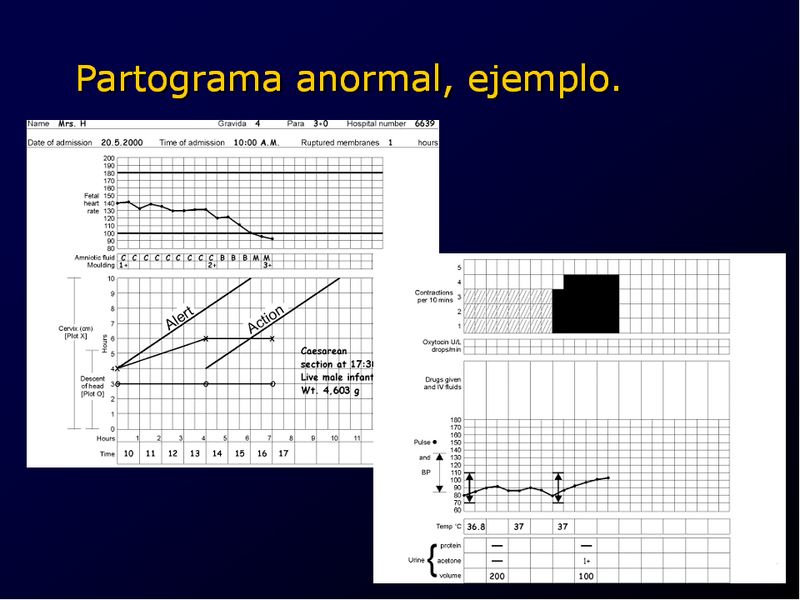 Diapositiva/Slide: 71/94