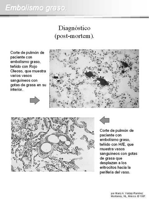 Diapositiva/Slide: 11/15