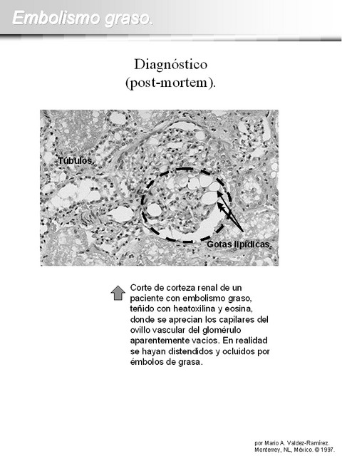 Diapositiva/Slide: 12/15