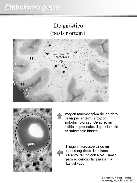 Diapositiva/Slide: 13/15