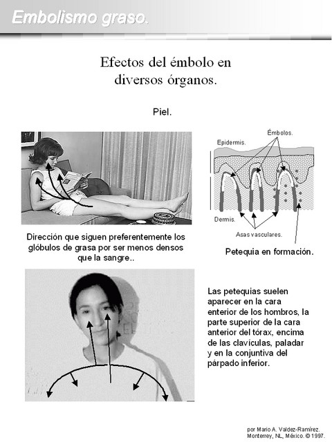 Diapositiva/Slide: 7/15