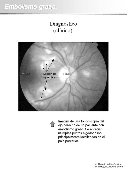 Diapositiva/Slide: 9/15