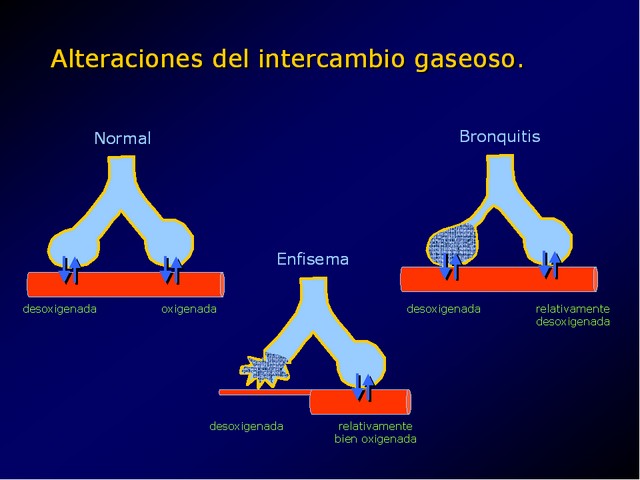 Diapositiva/Slide: 27/49