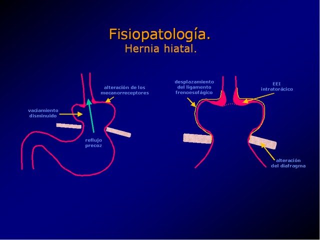 Diapositiva/Slide: 17/100