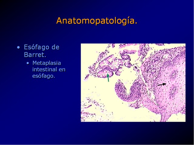 Diapositiva/Slide: 22/100