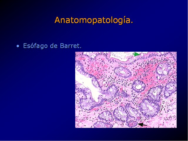 Diapositiva/Slide: 23/100