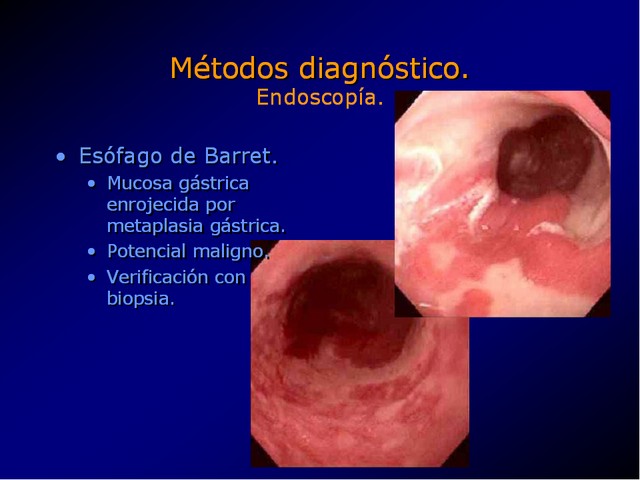 Diapositiva/Slide: 33/100