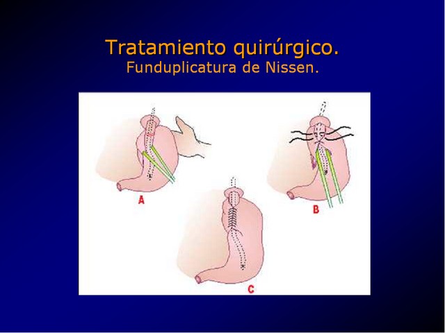 Diapositiva/Slide: 63/100