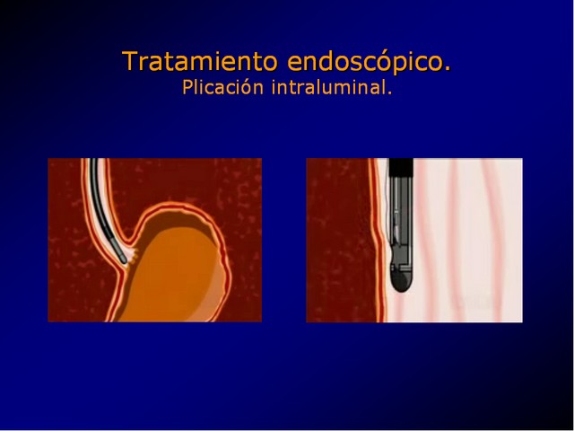 Diapositiva/Slide: 72/100