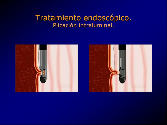 Diapositiva/Slide: 73/100