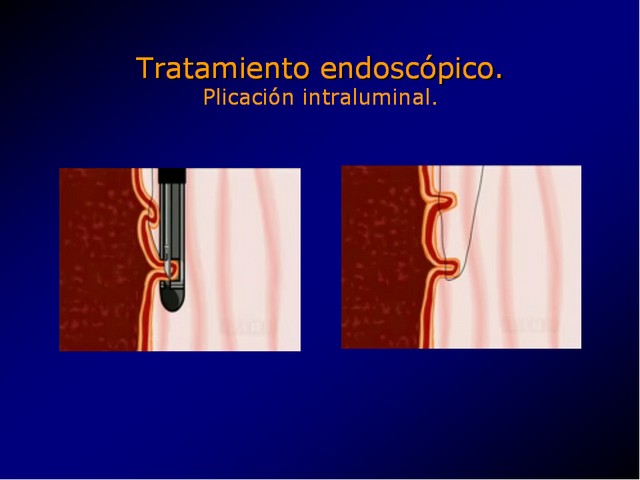 Diapositiva/Slide: 75/100