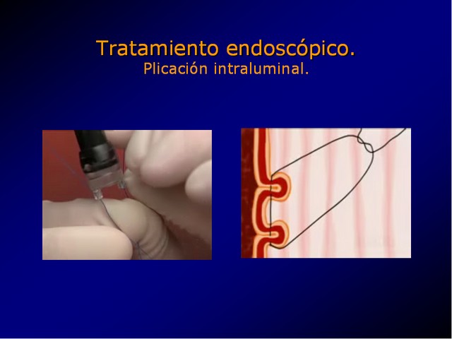 Diapositiva/Slide: 76/100