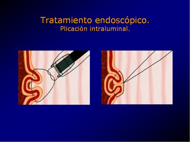 Diapositiva/Slide: 77/100