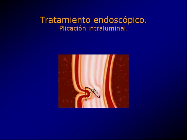 Diapositiva/Slide: 78/100