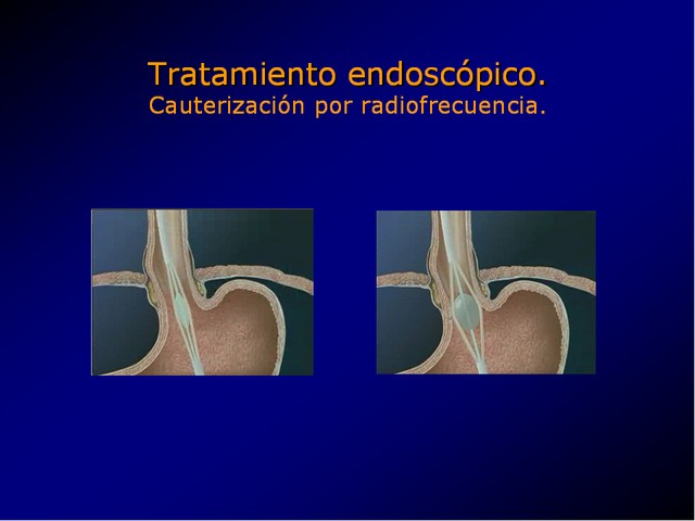 Diapositiva/Slide: 84/100