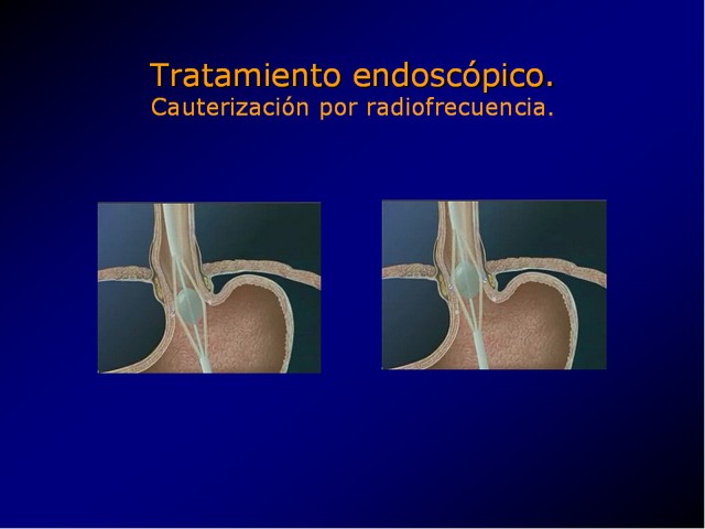 Diapositiva/Slide: 85/100