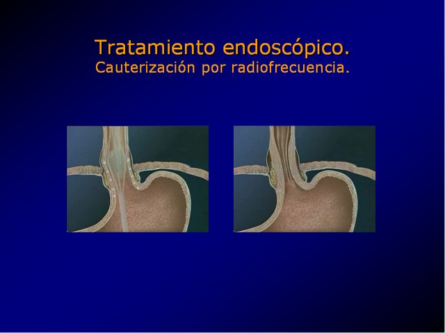 Diapositiva/Slide: 86/100