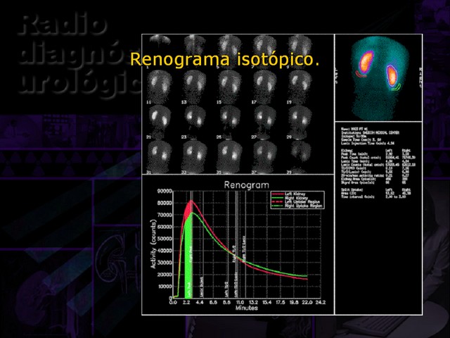 Diapositiva/Slide: 20/67