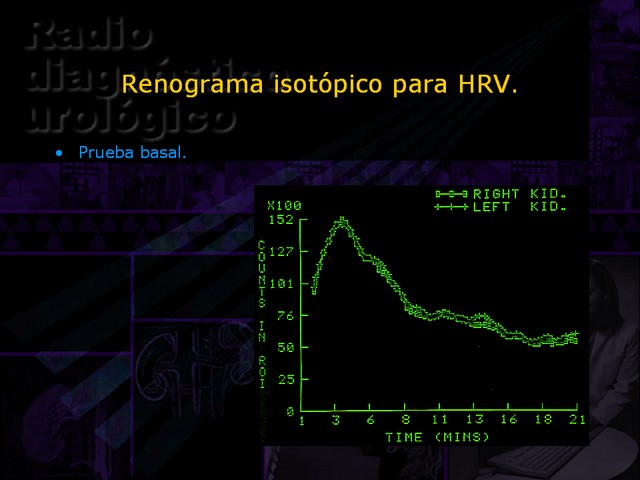 Diapositiva/Slide: 29/67