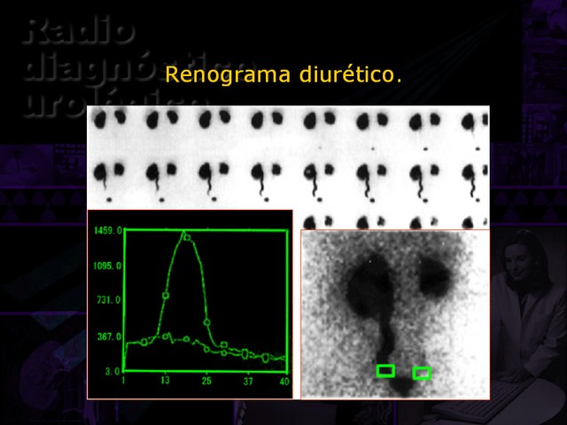 Diapositiva/Slide: 38/67