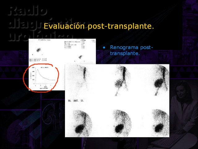 Diapositiva/Slide: 46/67