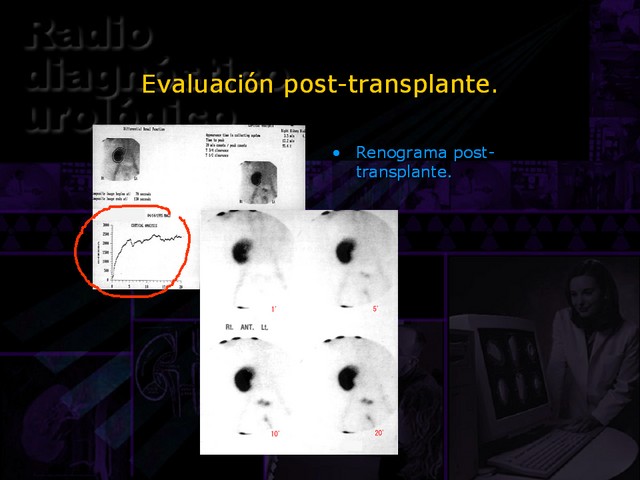 Diapositiva/Slide: 47/67