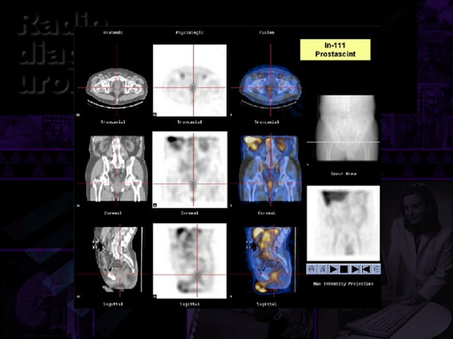 Diapositiva/Slide: 61/67