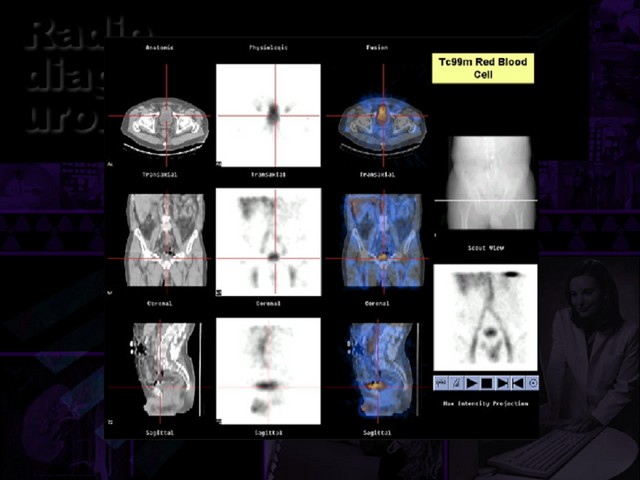 Diapositiva/Slide: 62/67