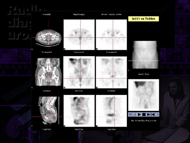 Diapositiva/Slide: 63/67