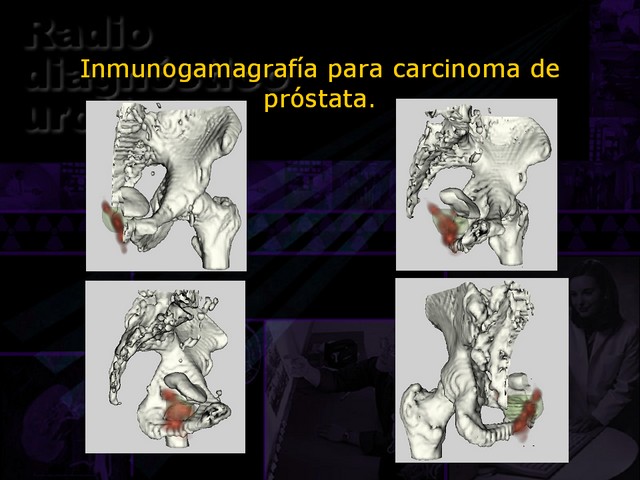 Diapositiva/Slide: 64/67