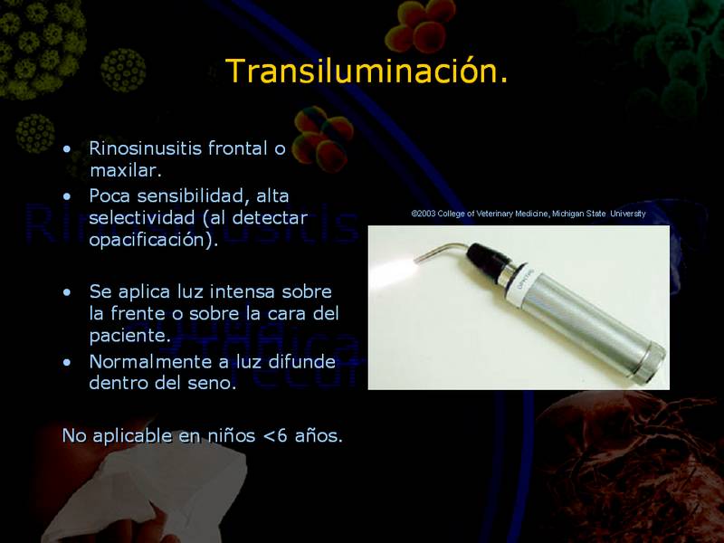 Diapositiva/Slide: 17/67