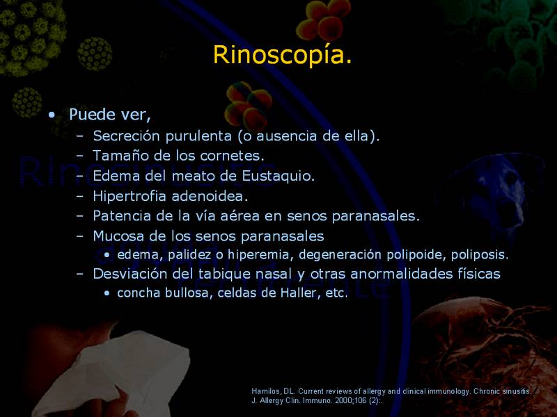 Diapositiva/Slide: 22/67