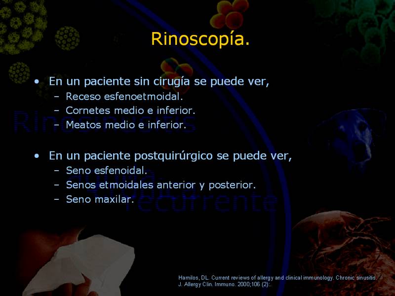 Diapositiva/Slide: 23/67