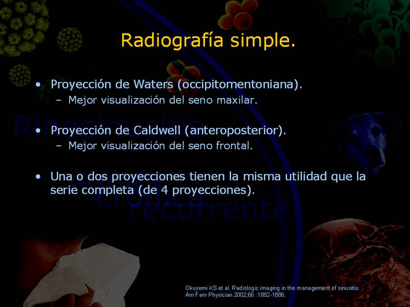 Diapositiva/Slide: 28/67