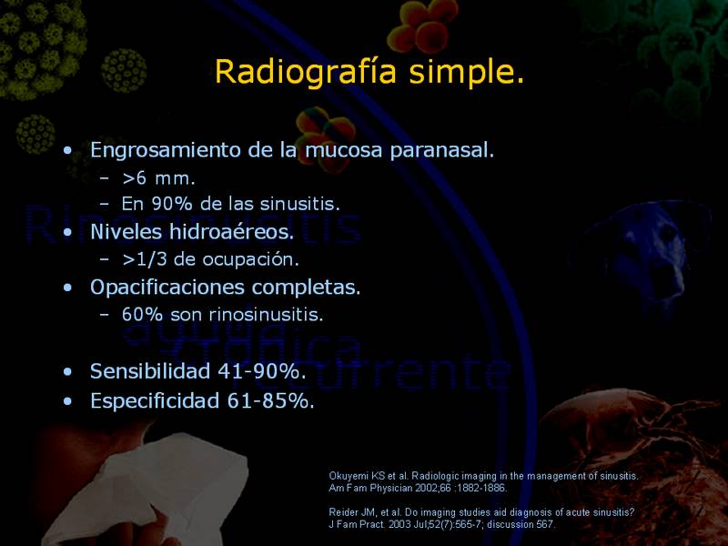 Diapositiva/Slide: 29/67