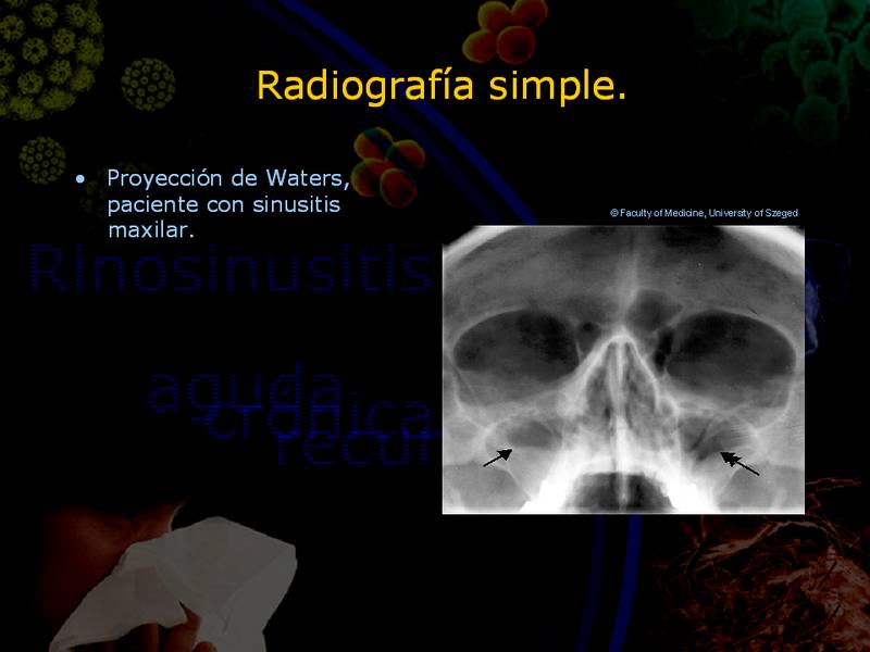 Diapositiva/Slide: 31/67