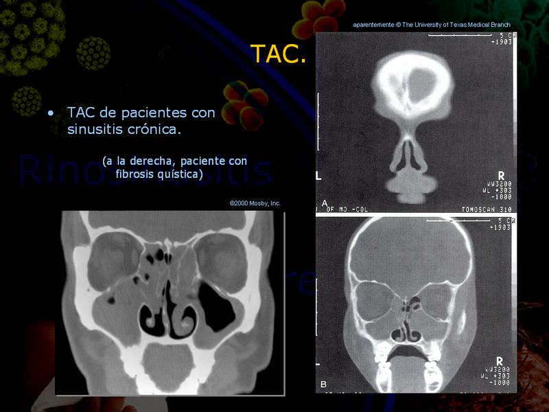 Diapositiva/Slide: 36/67