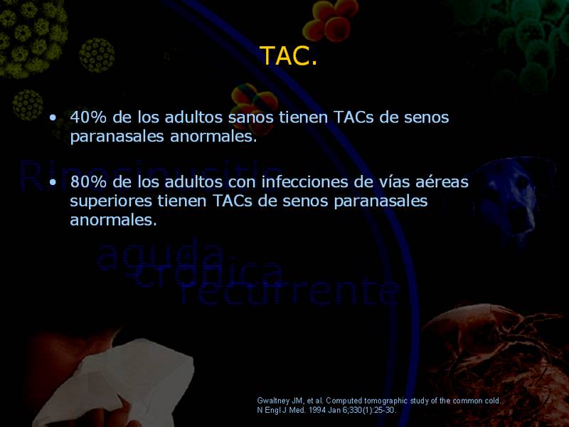 Diapositiva/Slide: 37/67