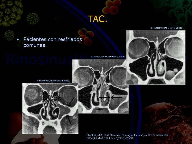 Diapositiva/Slide: 38/67