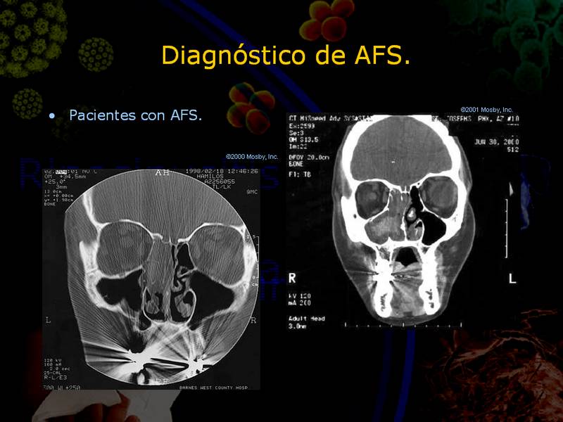 Diapositiva/Slide: 60/67