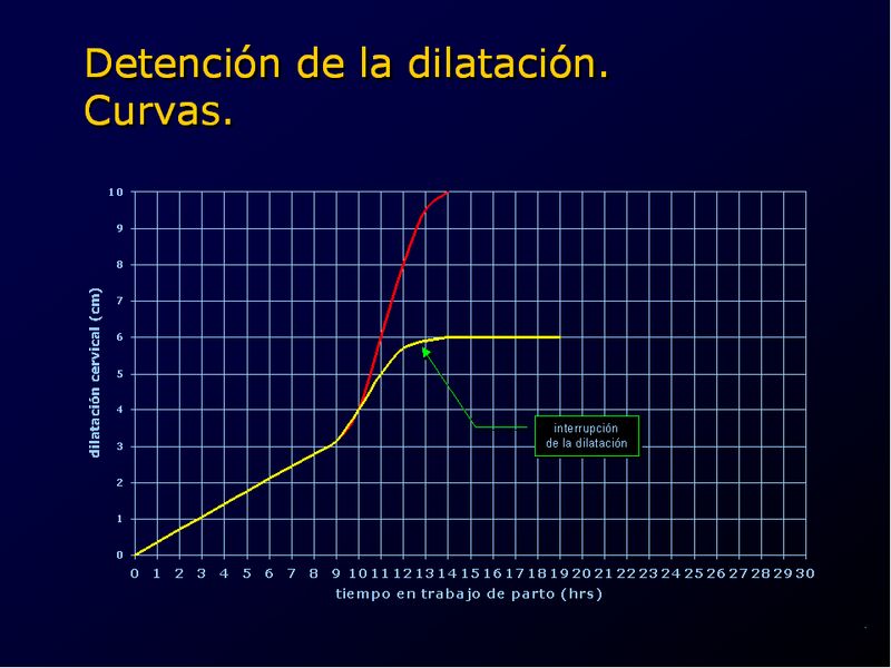 Diapositiva/Slide: 47/94